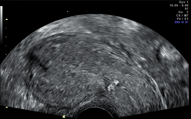 ultrasoundsmall