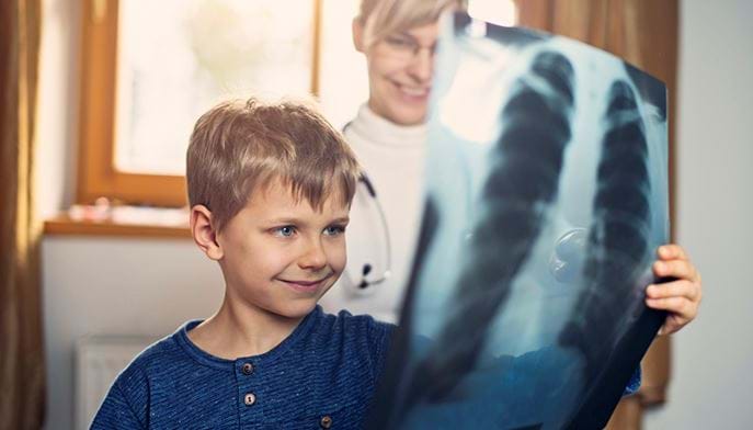En gutt som holder opp et røngtenbilde av en brystkasse, med en lege i bakgrunnen. Foto: Istockphoto.com