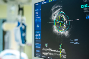 Intravascular ultralyd bilde på maskin (IVUS) . Foto: Istockphoto.com