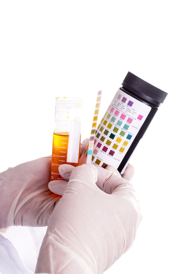 Bilde av test av urinveisinfeksjon - strips Morsphotos