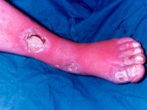 arterielle_sr_02_max