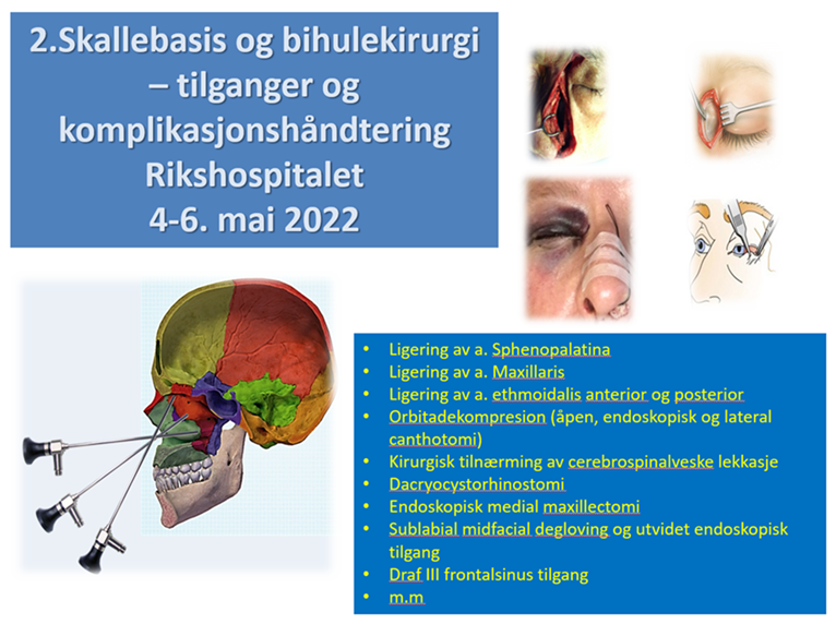 Skallebasis og bihulekirurgi