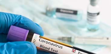 Pr&#248;ver&#248;r med blod merket positiv koronavirustest. Foto: Istockphoto.com