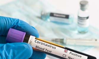 Prøverør med blod merket positiv koronavirustest. Foto: Istockphoto.com