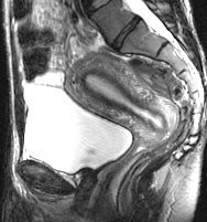 JZ MRI