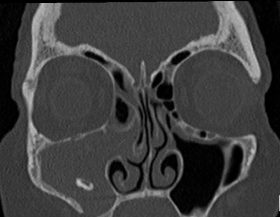 Head and Neck 3 day Intensive Imaging Course