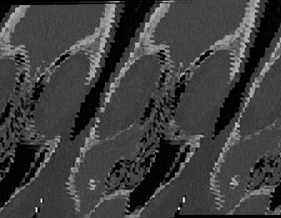 Head and Neck 3 day Intensive Imaging Course