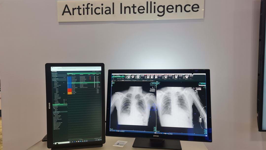 Programvare som kan tolke røntgen