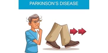 Illustrasjon fra Colourbox.com  om Parkinsons sykdom