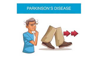 Illustrasjon fra Colourbox.com  om Parkinsons sykdom