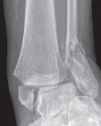 OA Case Reports 1 (1). DOI:10.13172/2052-0077-1-1-288. ISSN 2052-0077.  Creative Commons Attribution license