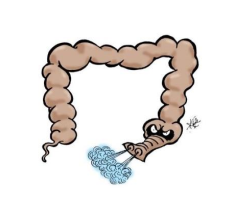 Bilde av en slange utformet som tarm