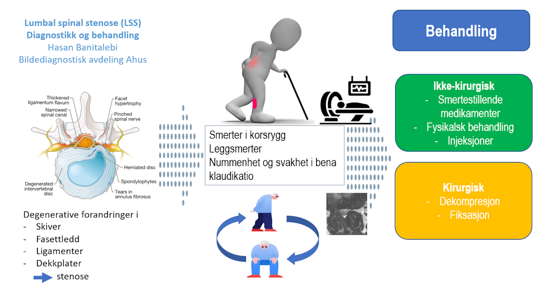 Banitalebi grafisk abstract